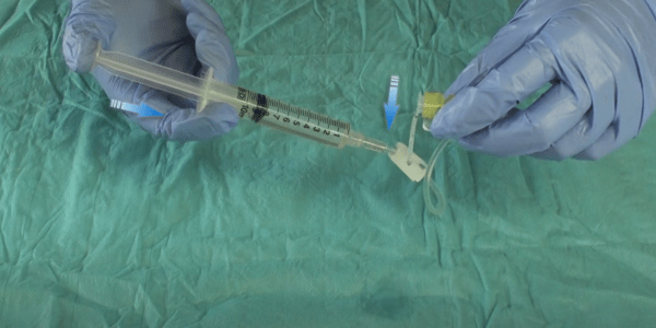 PPS Flow + Safety Huber Needle with automatic positive pressure