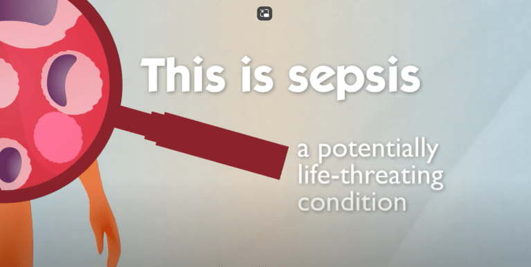 Sepsis_Day